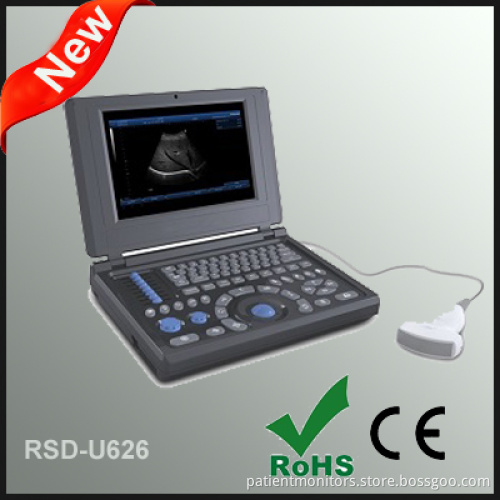 Laptop Full Digital Ultrasonic Diagnostic System